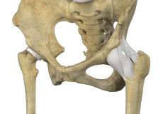 Hip Ligament Injuries