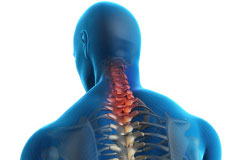 Neck Strains and Sprains